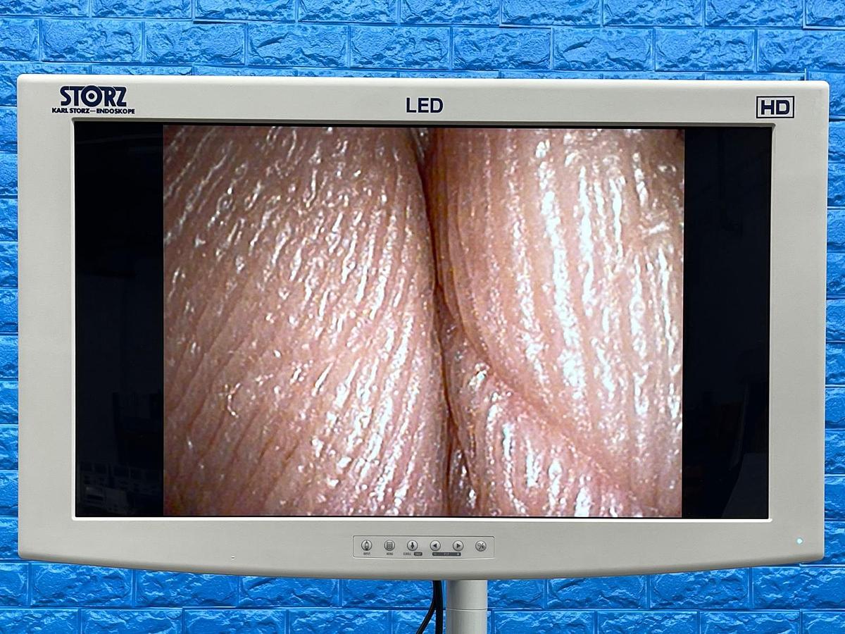 Used Karl Storz 11272 VN Cysto-Urethroscope