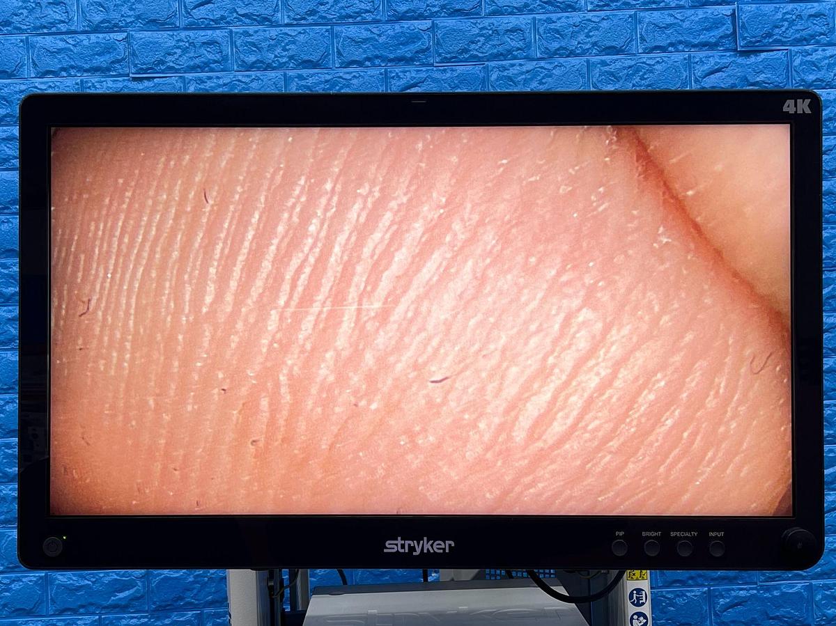 Used Stryker 1688 4K Tower  Lcd Monitor 4k 32” YOM: 2020