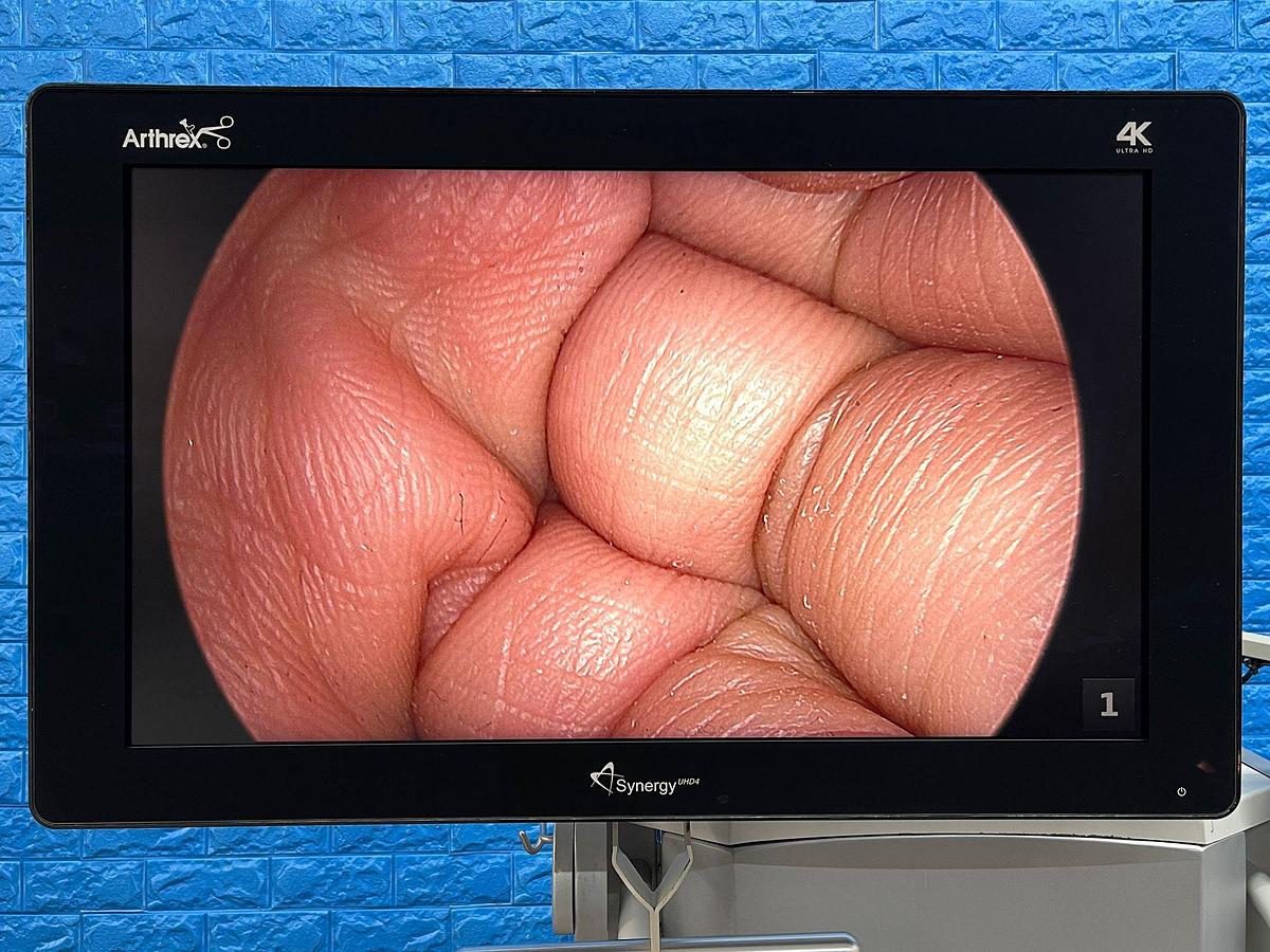 Used ARTHREX Synergy UHD4 4K Tower LED 4K Monitor 32 inch YOM: 2018