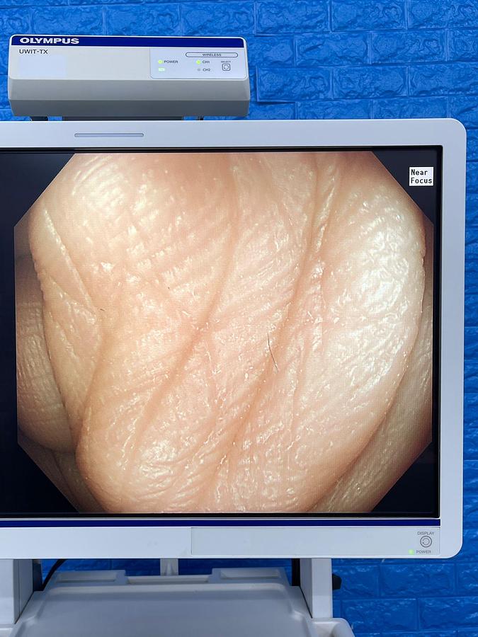 Used Olympus CF-HQ290L Colonoscope