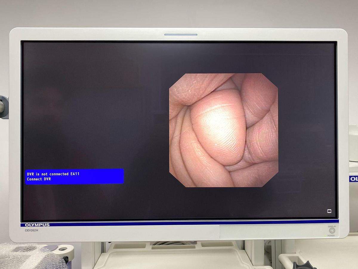 Used Olympus scope Mode: GIF-N180