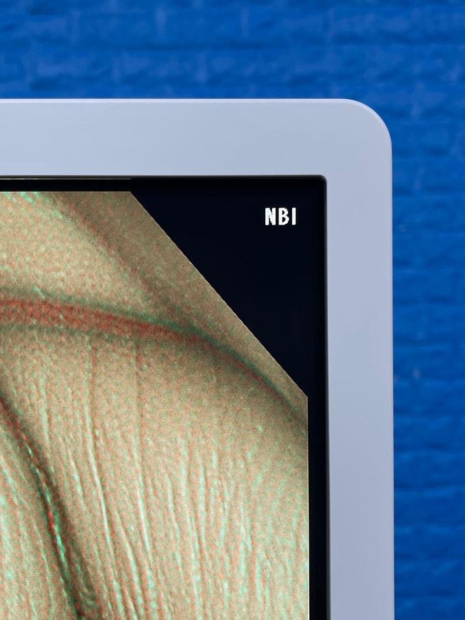 Used Olympus CF-HQ290L Colonoscope