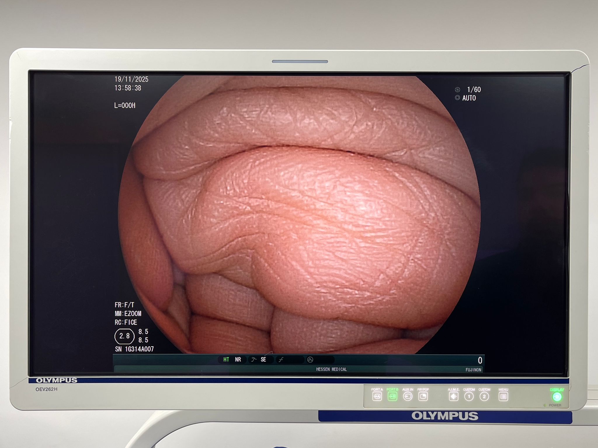 Used Fujinon Scope Model: EG-530FP Gastroscope