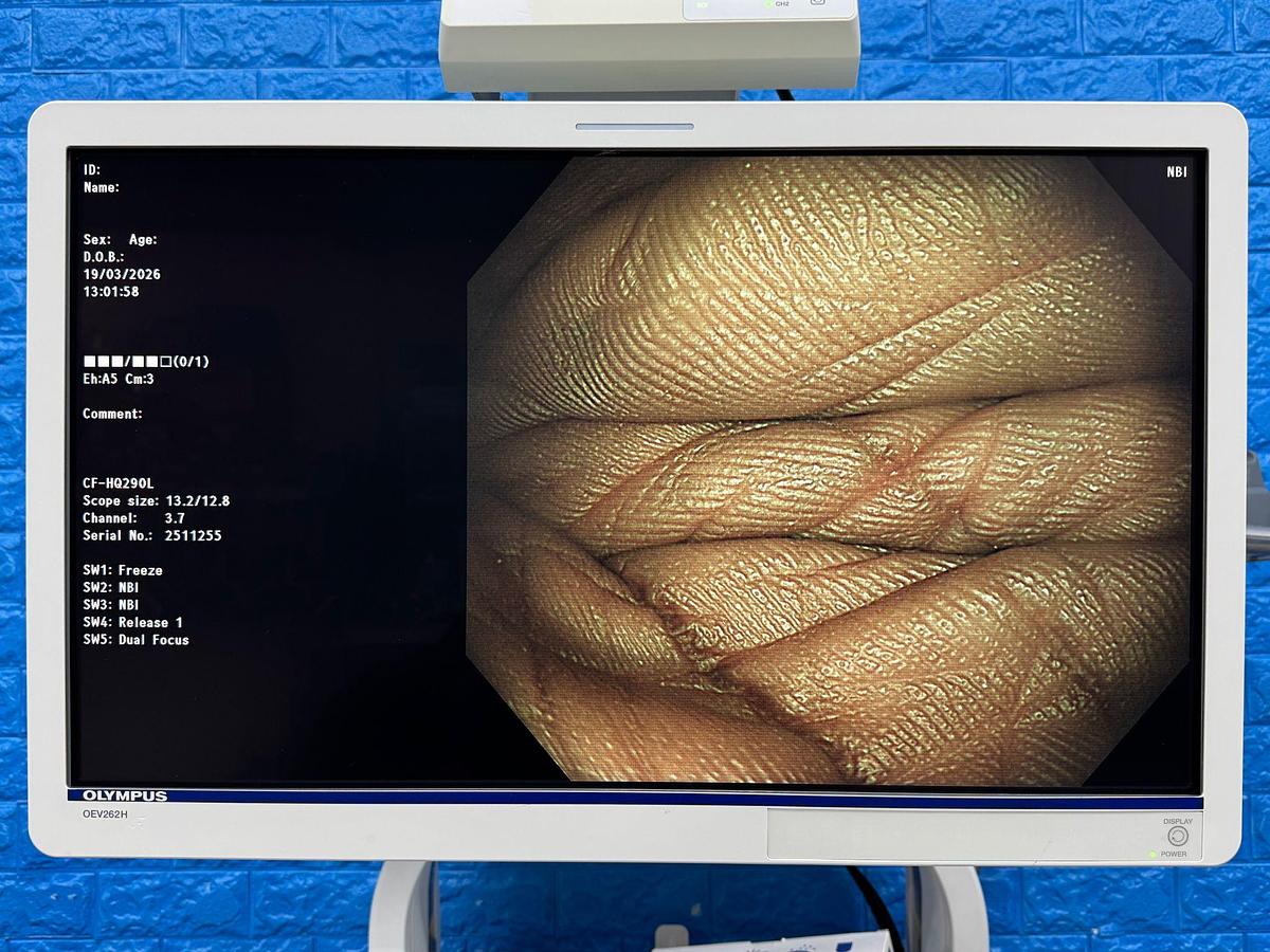 Used  Olympus Scope  Model: CF-HQ290L