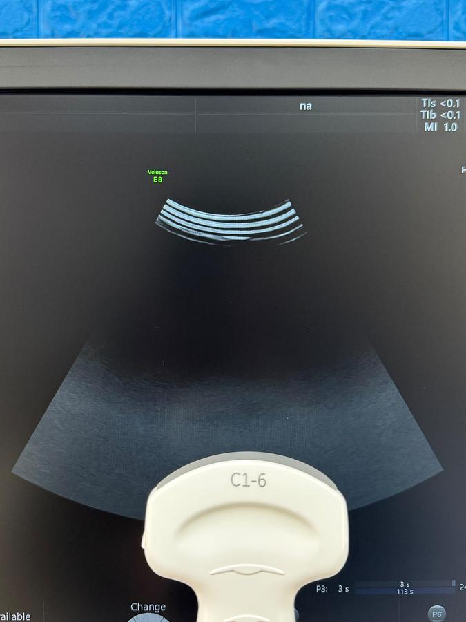 Used GE Voluson E8 Ultrasound YOM: 2019  Probes  - C1-6-D YOM: 2019 - C2-9-D YOM: 2014 - IC5-9-D 