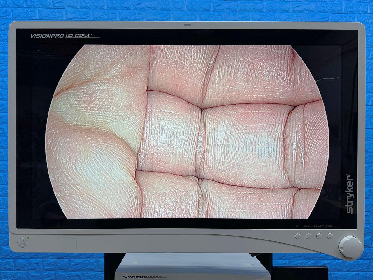 Used Stryker 1488 Stryker 1488 Processor  YOM: 2017 SN: 17E519814 Stryker L9000 LED Light Source  YOM: 2014 SN: 14G015694 Stryker 1488 Camera Head SN: 17L520714