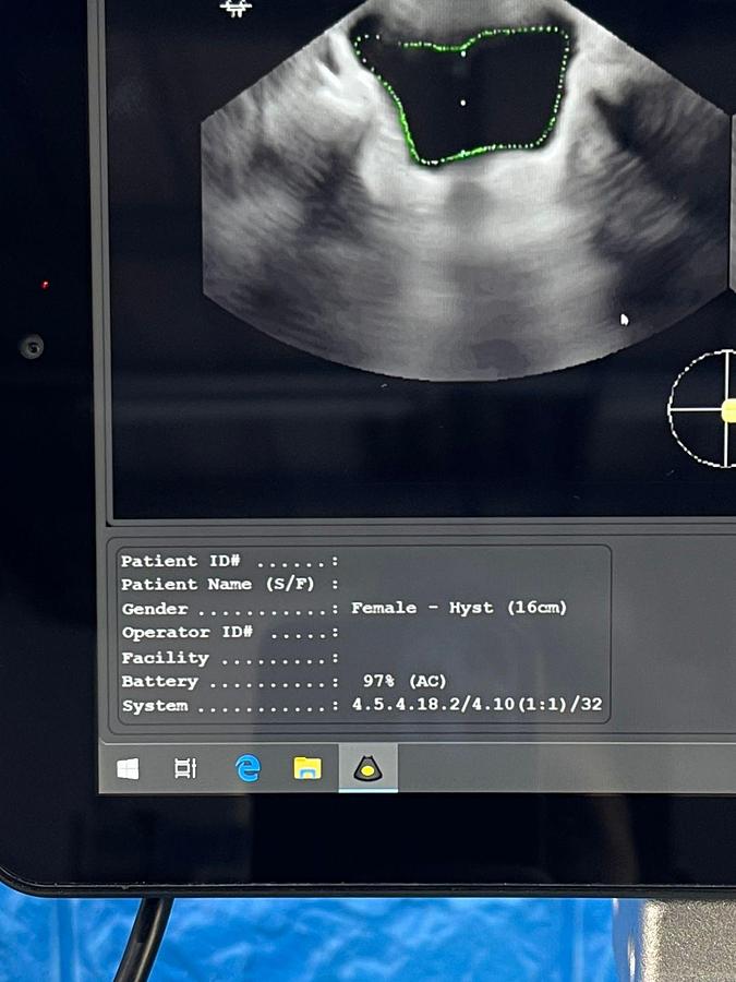 Used Vitacon VitaScan LT Urology Ultrasound With Vitascan V2 Probe.