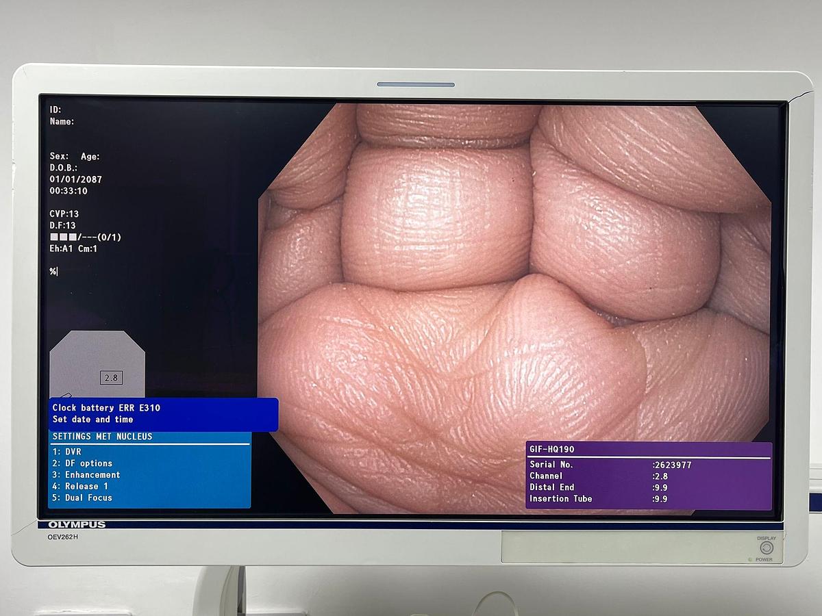 Used Olympus Scope Model: GIF-HQ190