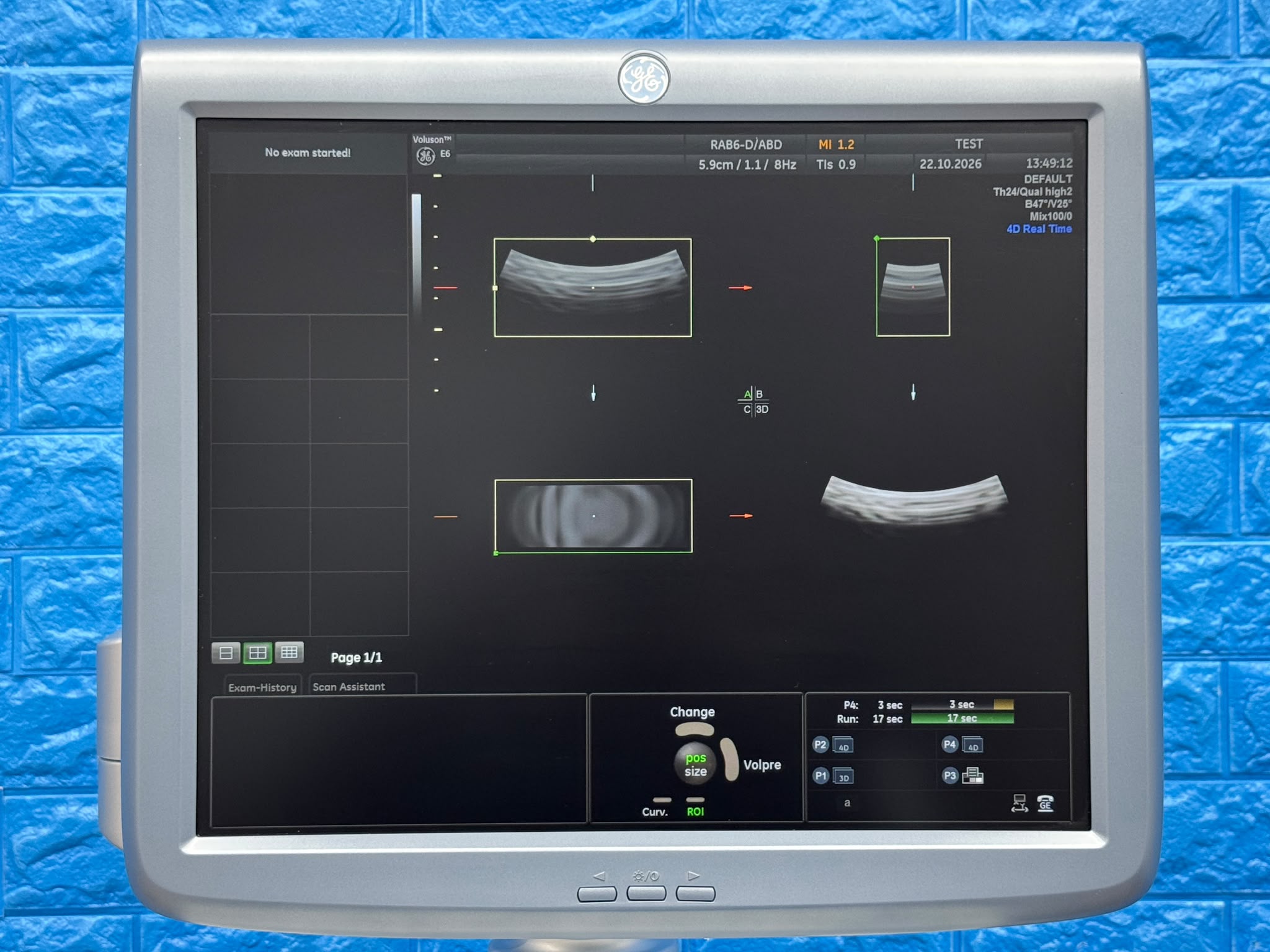 Used GE Voluson Е6 Ultrasound YOM: 2013