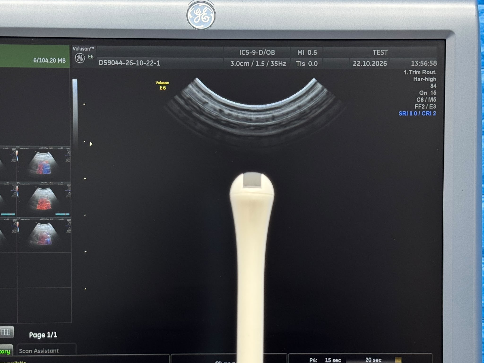 Used GE Voluson Е6 Ultrasound YOM: 2013