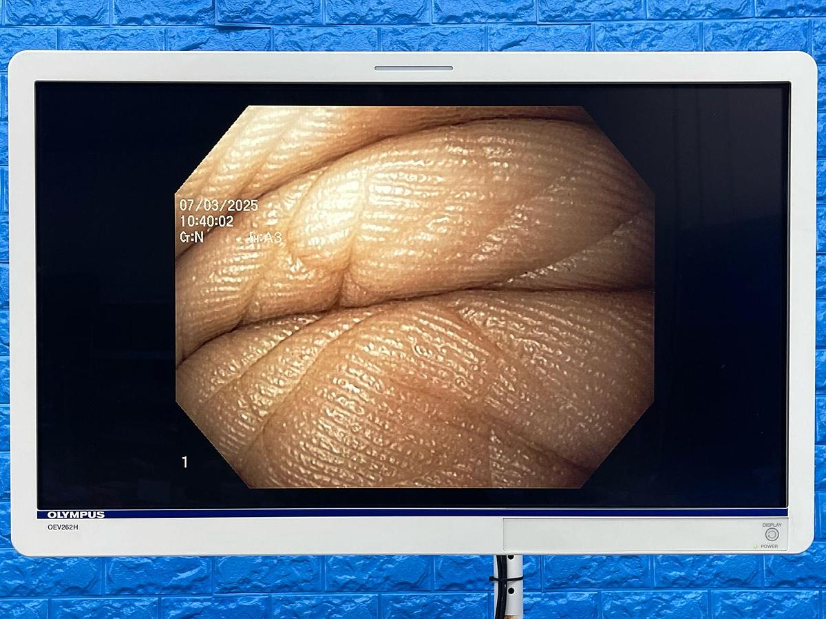 Used Olympus Scope Model: GIF-H180J