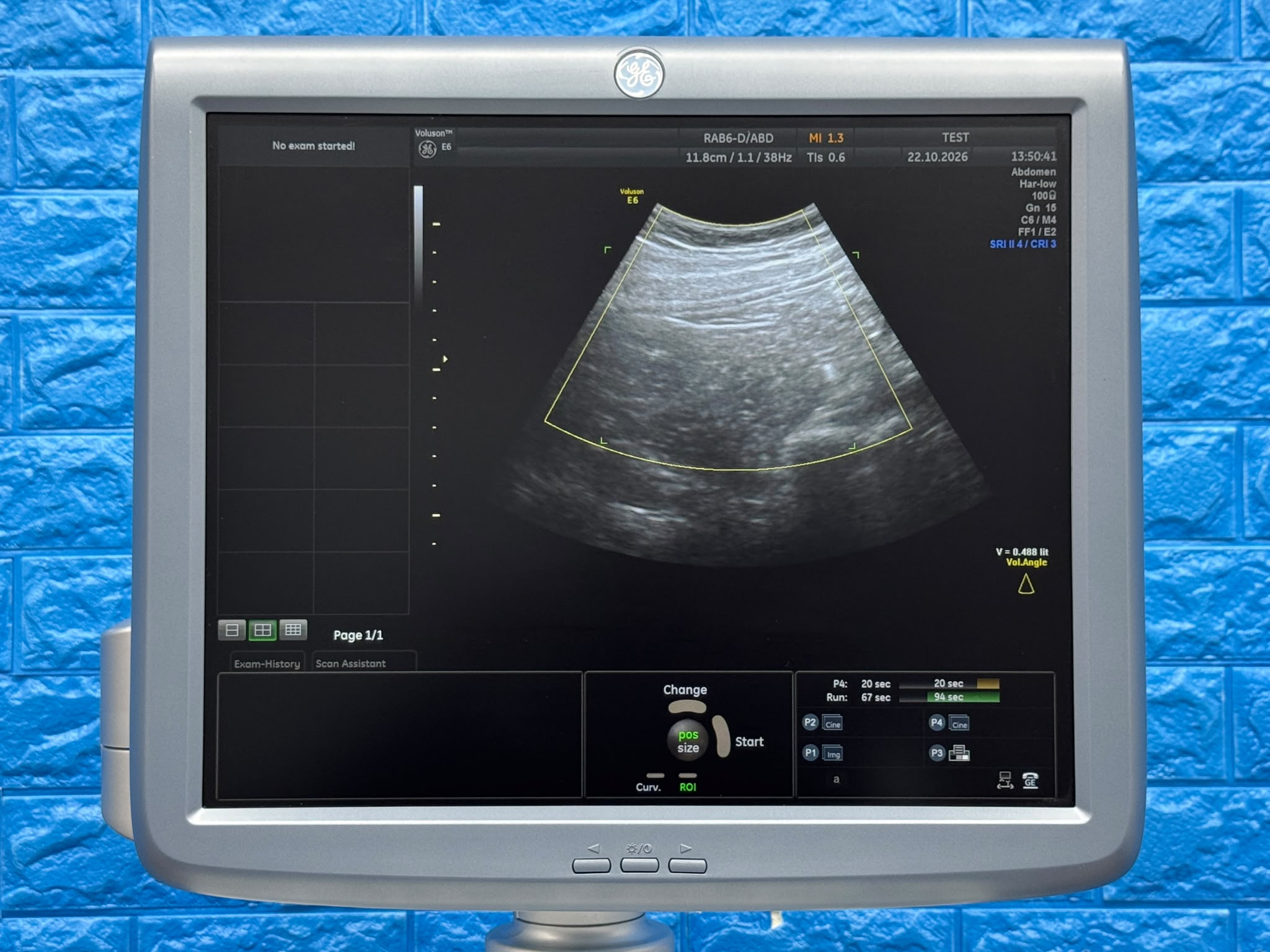 Used GE Voluson Е6 Ultrasound YOM: 2013