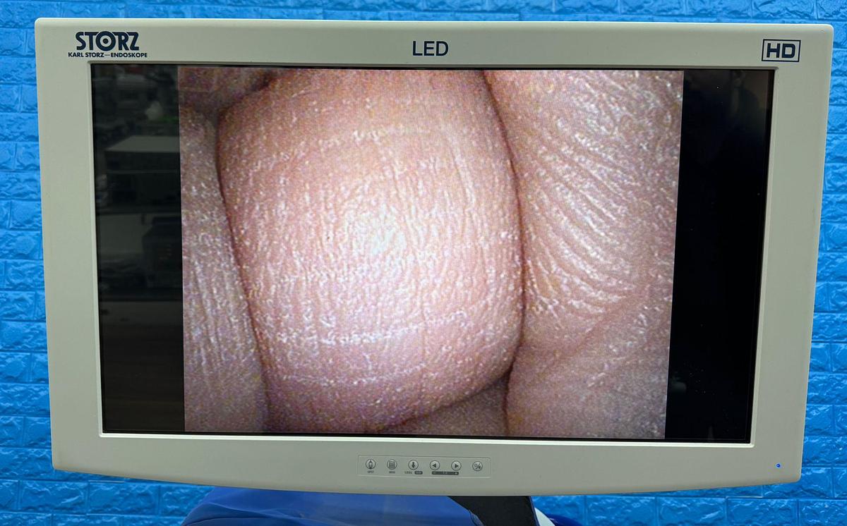 Used