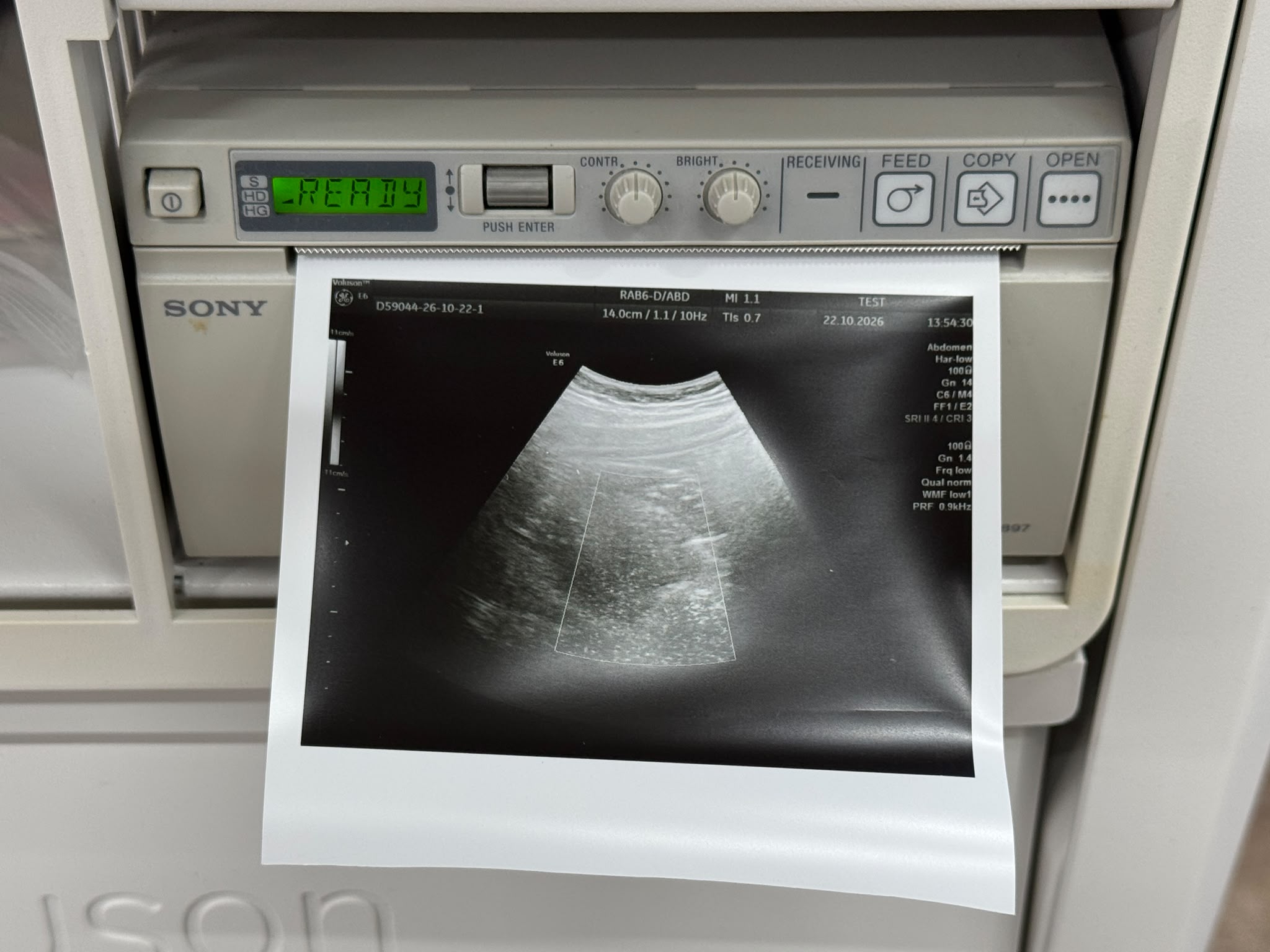 Used GE Voluson Е6 Ultrasound YOM: 2013