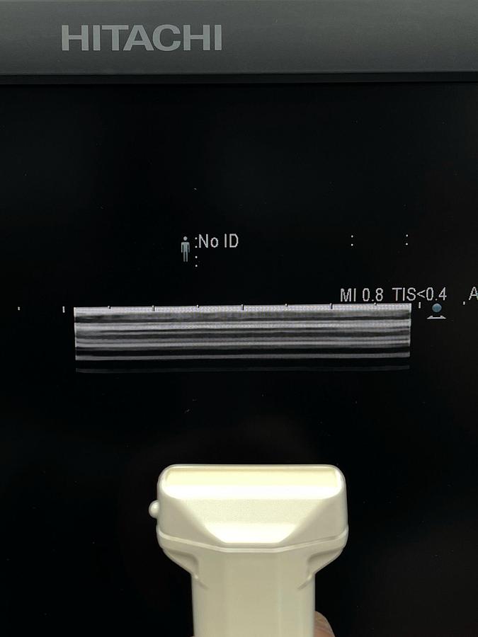 Used Hitachi Aloka Arietta V70 Ultrasound  YOM: 2016 With 5x Probes