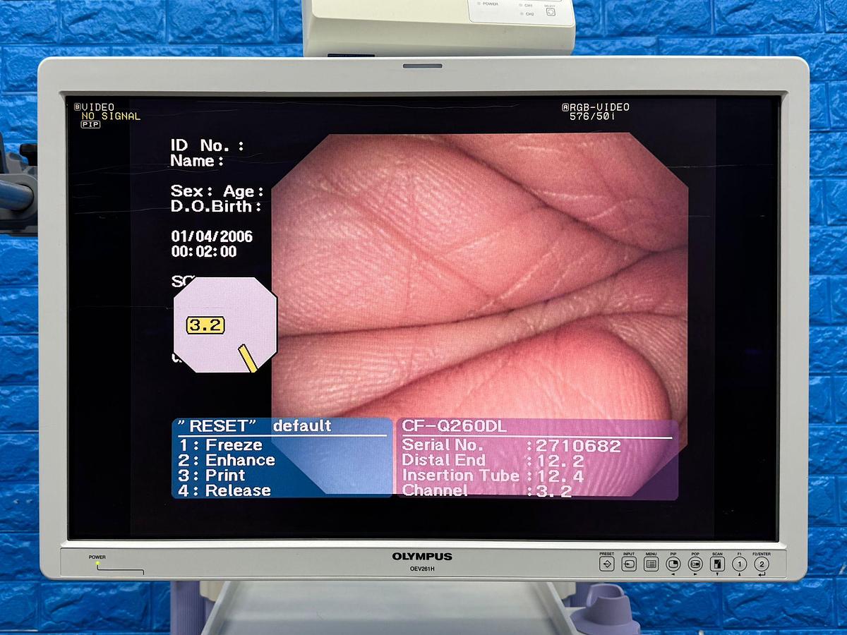 Used Olympus Scope Model: CF-Q260DL 