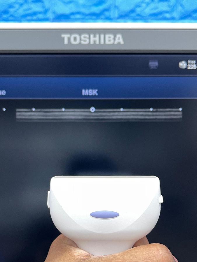 Used -Toshiba Ultrasound Aplio 500 YOM: 2015