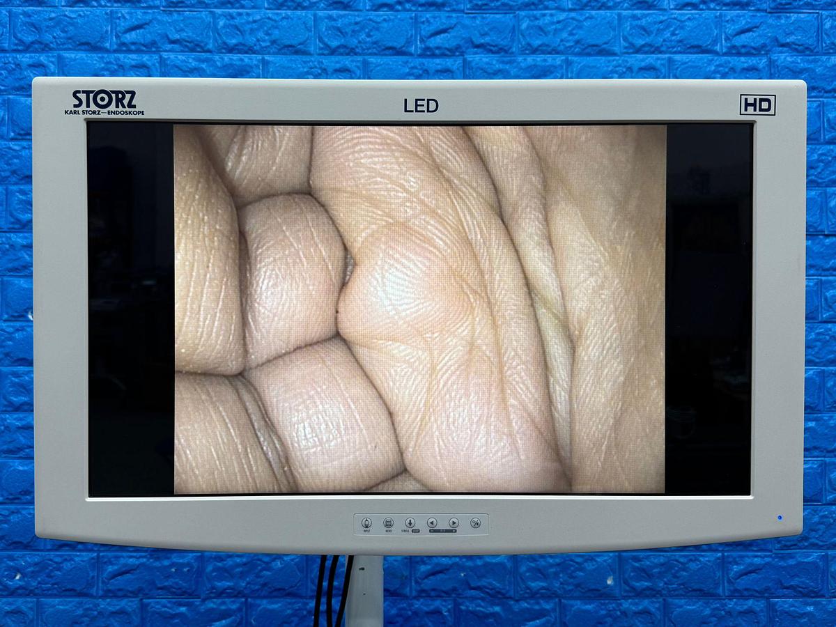 Used Karl Storz 13924 PKS Colonoscope