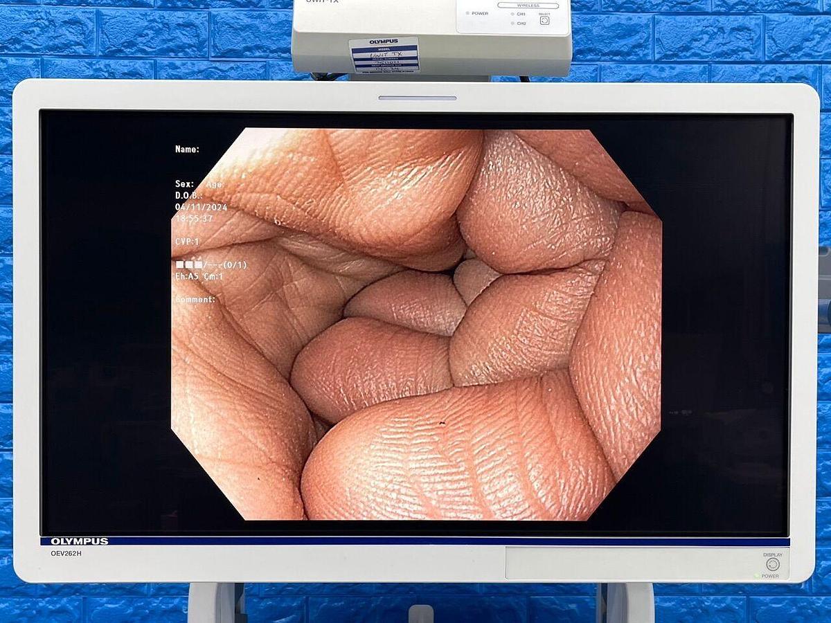 Used OLYMPUS CV-190/CLV-190 Tower Endoscope