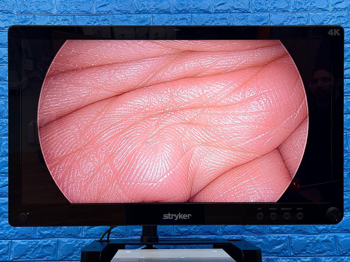 Used Stryker 1688 4K Tower