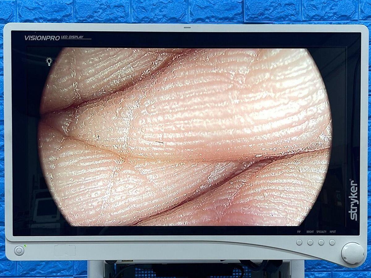 Used STRYKER 1588 Tower Lcd Monitor YOM