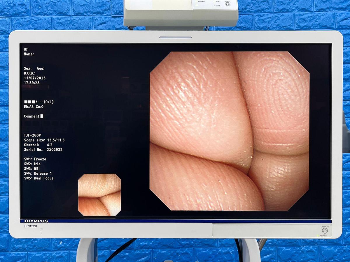 Used Olympus TFJ-260V Duodenoscope