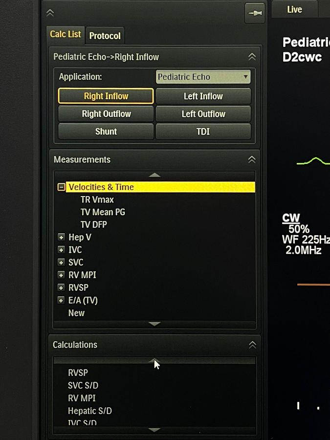 Used PHILIPS EPIQ 7C Ultrasound SW: HW B.0 YOM: 2018 Cardiac – Vascular Ultrasound