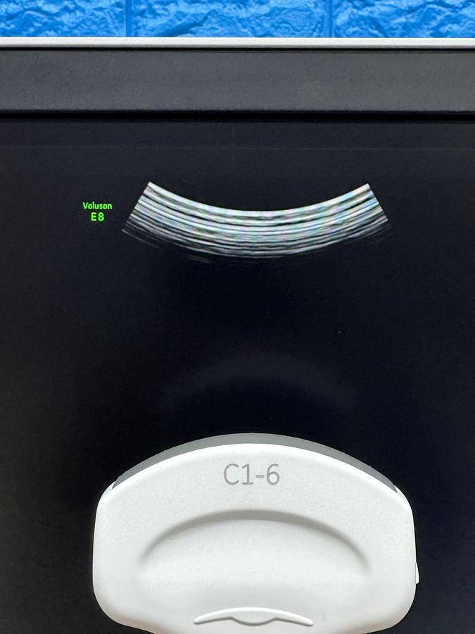 Used GE Voluson E8 Ultrasound YOM: 2020