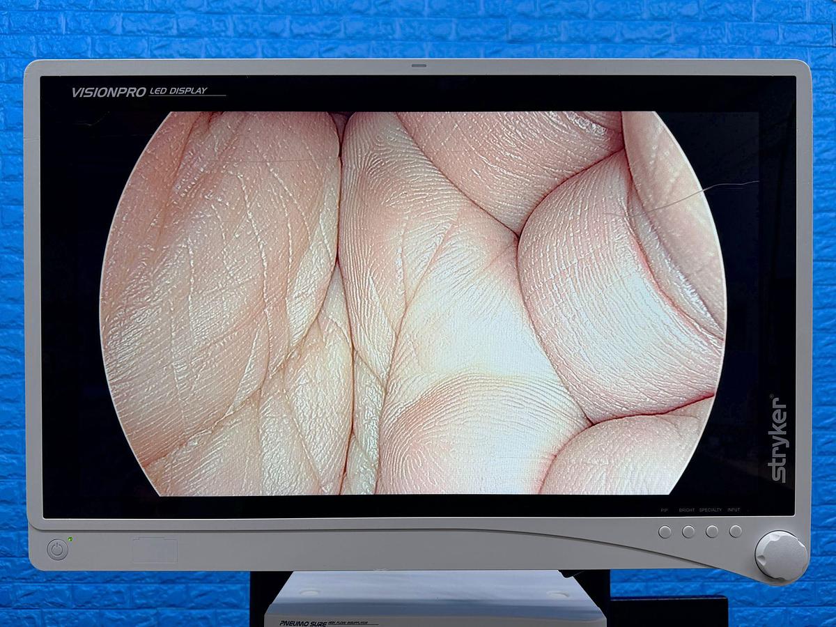 Used Stryker 1488 Stryker 1488 Processor  YOM: 2017 SN: 17E519814 Stryker L9000 LED Light Source  YOM: 2014 SN: 14G015694 Stryker 1488 Camera Head SN: 17L520714