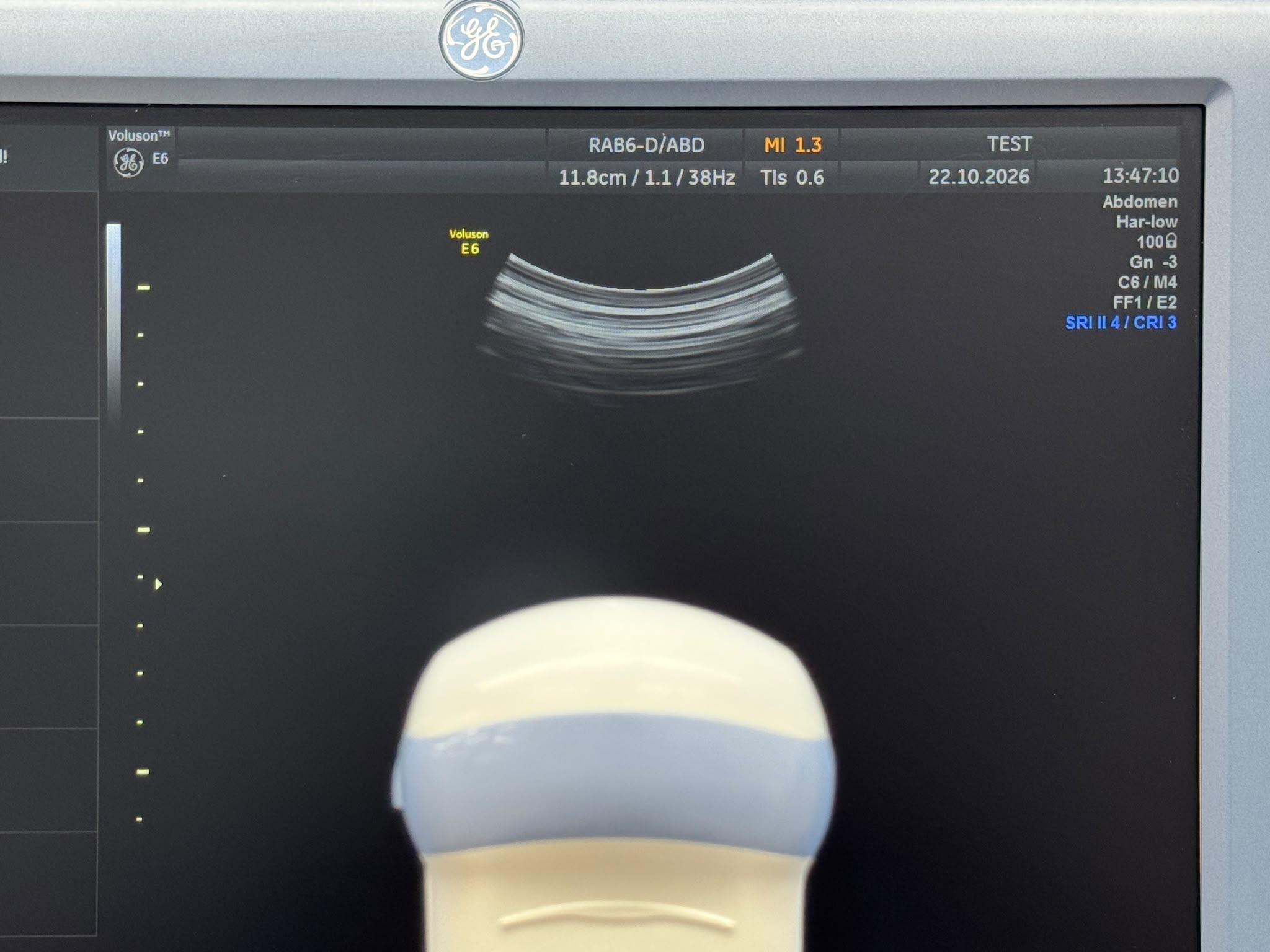 Used GE Voluson Е6 Ultrasound YOM: 2013