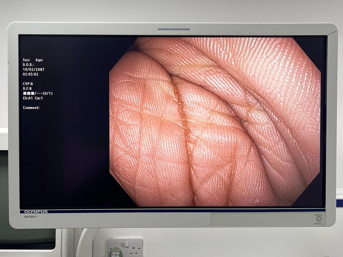 Used Olympus Scope GIF-1TH190