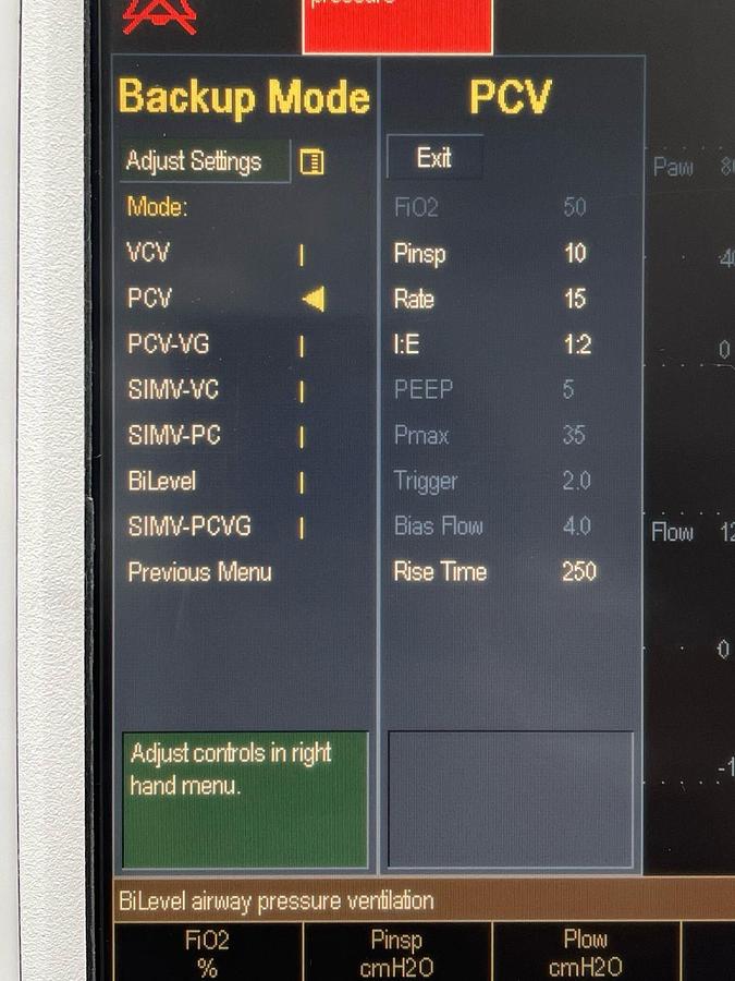 Used GE Engstrom Ventilator SW: 06.01 Hours: 21227 YOM: 2009