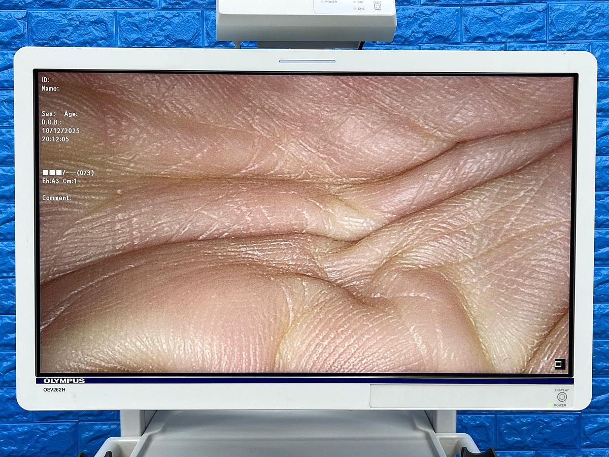 Used Olympus Camera Head Model: CH-S190-XZ-E 