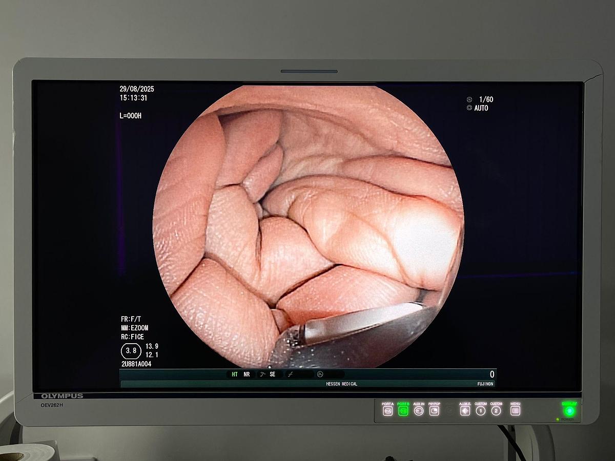 Used Fujinon Scope Model: EG-530UT YOM: 2008 