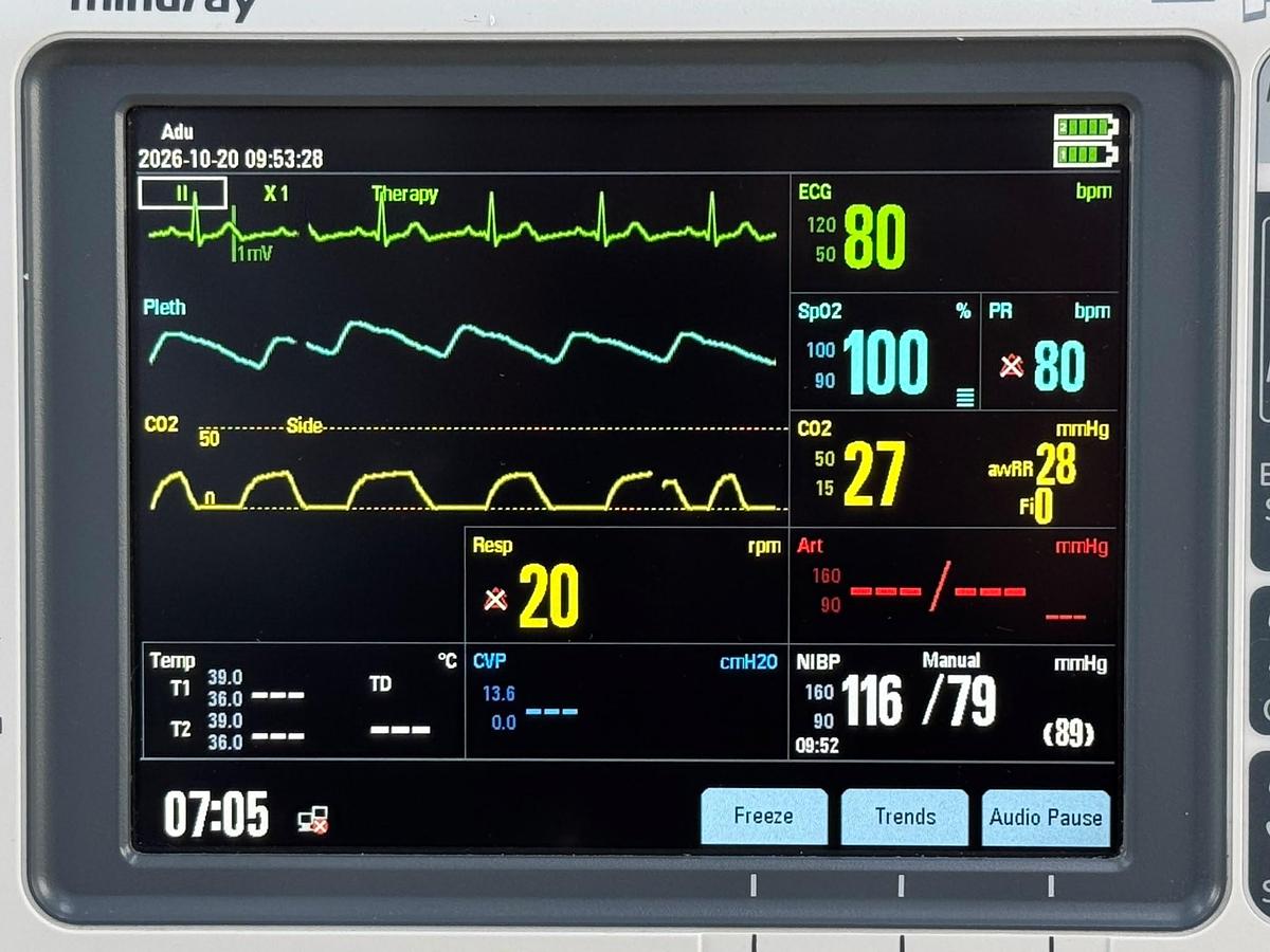 Used Mindray BeneHeart D6 Defibrillator