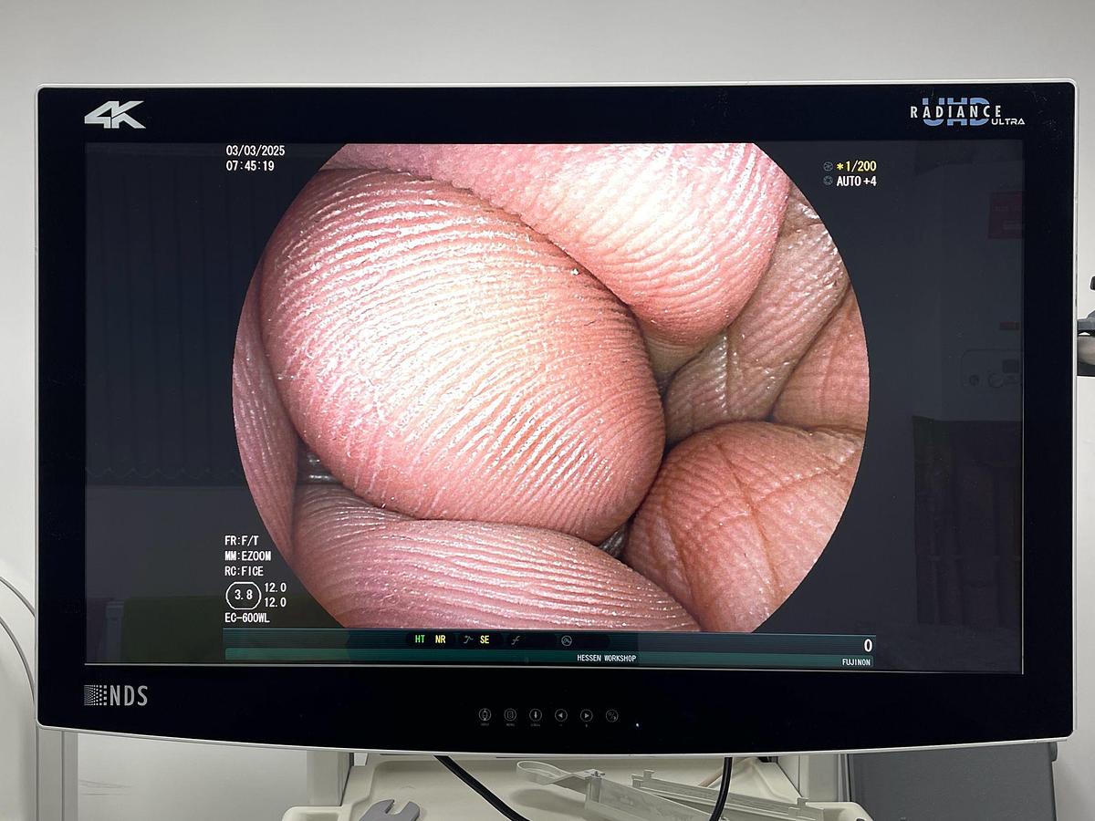 Used FUJINON Scope Model: EC-600WL