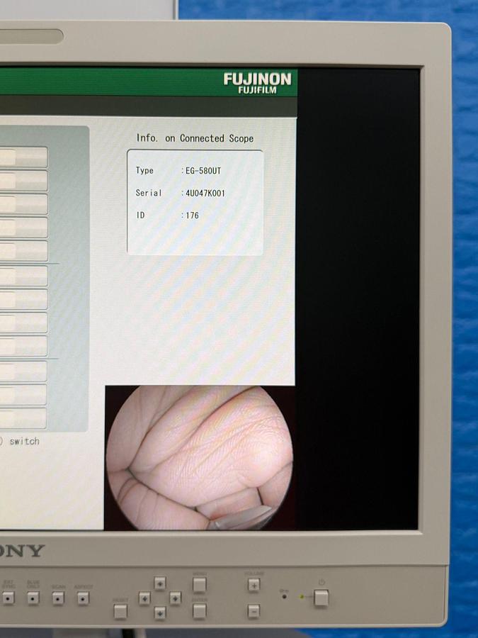 Used Fujinon Scope EG-580 UT Linear Ultrasonic Endoscope YOM: 2018 