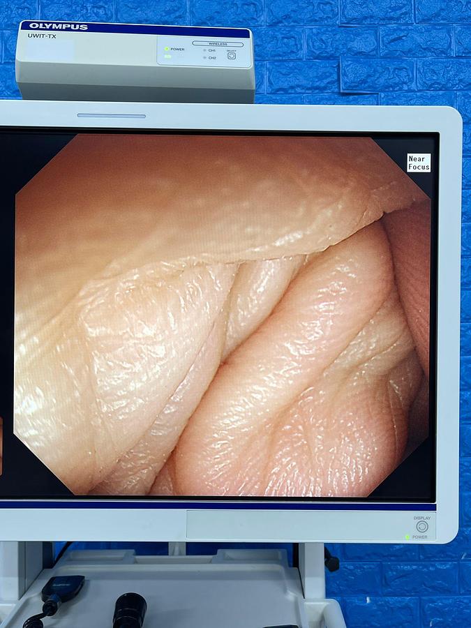 Used Olympus Scope Model: GIF-HQ290