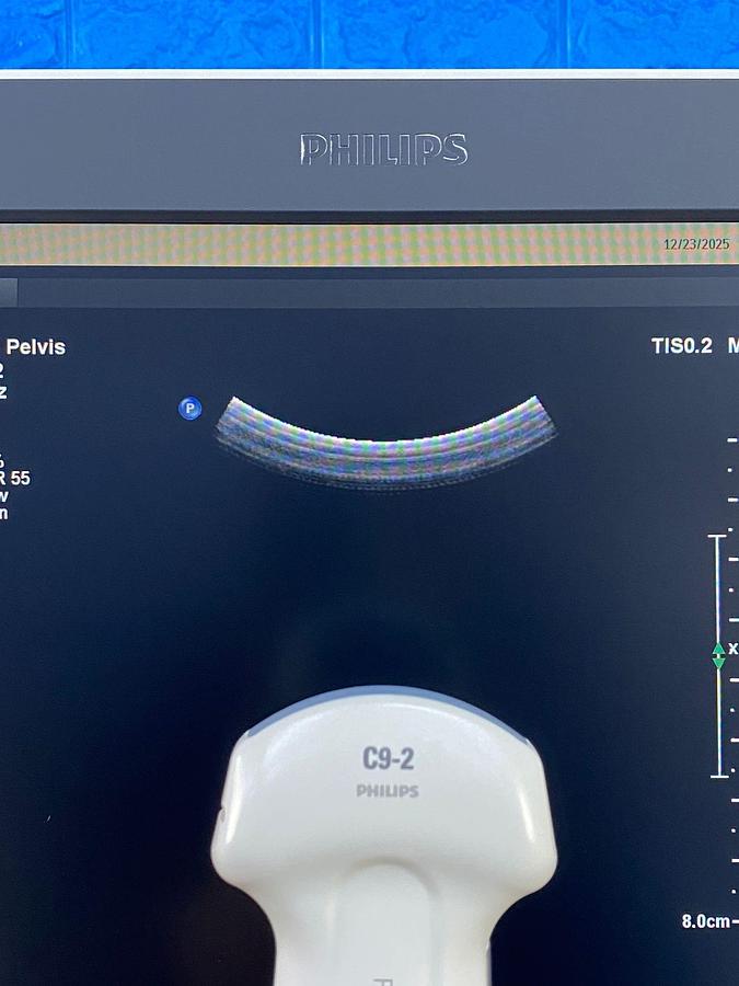 Used Philips Affiniti 70G PureWave Software Version: 9.0.16 Hardware B.0 YOM: 2018 Probes L15-7io C10-3v C9-2 C5-1
