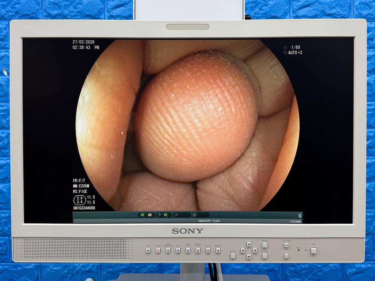 Used Fujinon Scope  Model: EG-530D 