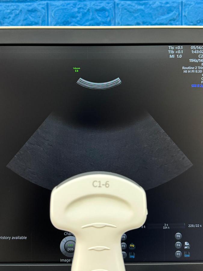 Used GE Voluson E8 Ultrasound YOM: 2019  