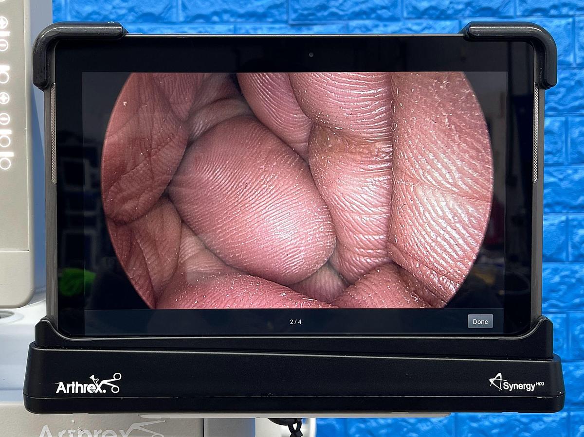 Used Arthrex Synergy HD3 Tower