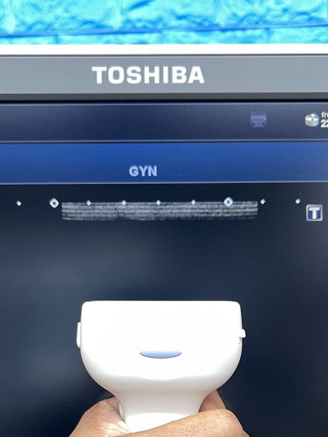 Used Toshiba Ultrasound Aplio 500 YOM: 2015