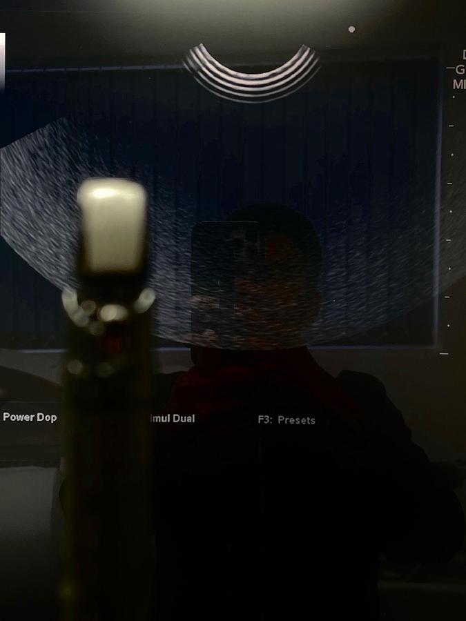 Used Fujinon Scope Model: EG-530UT YOM: 2008 