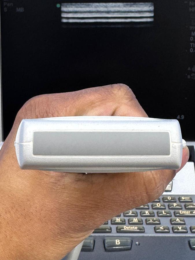 Used SonoSite Fujifilm M-Turbo Ultrasound REF: P08189-45 YOM: 2010 Probe HFL38x/13-6 MHz REF: PO7682-20 YOM: 2010