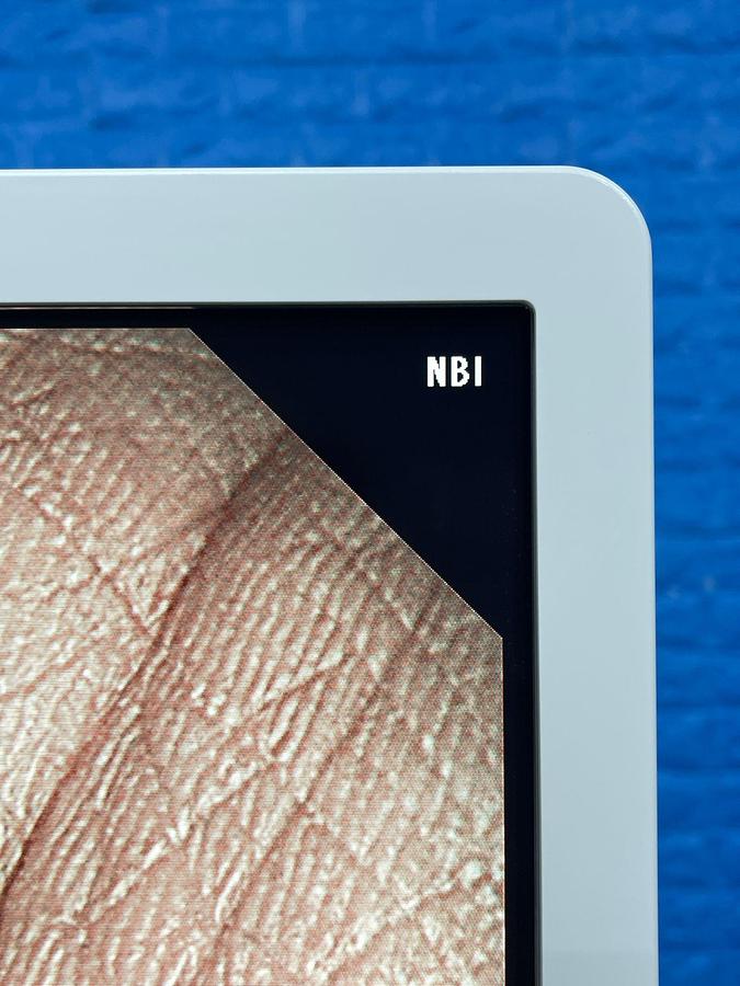 Used Olympus GIF-HQ290 Gastroscope