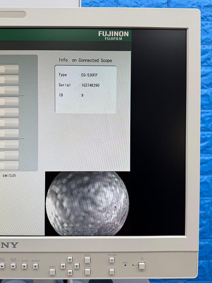Used Fujinon Scope  Model: EG-530FP 