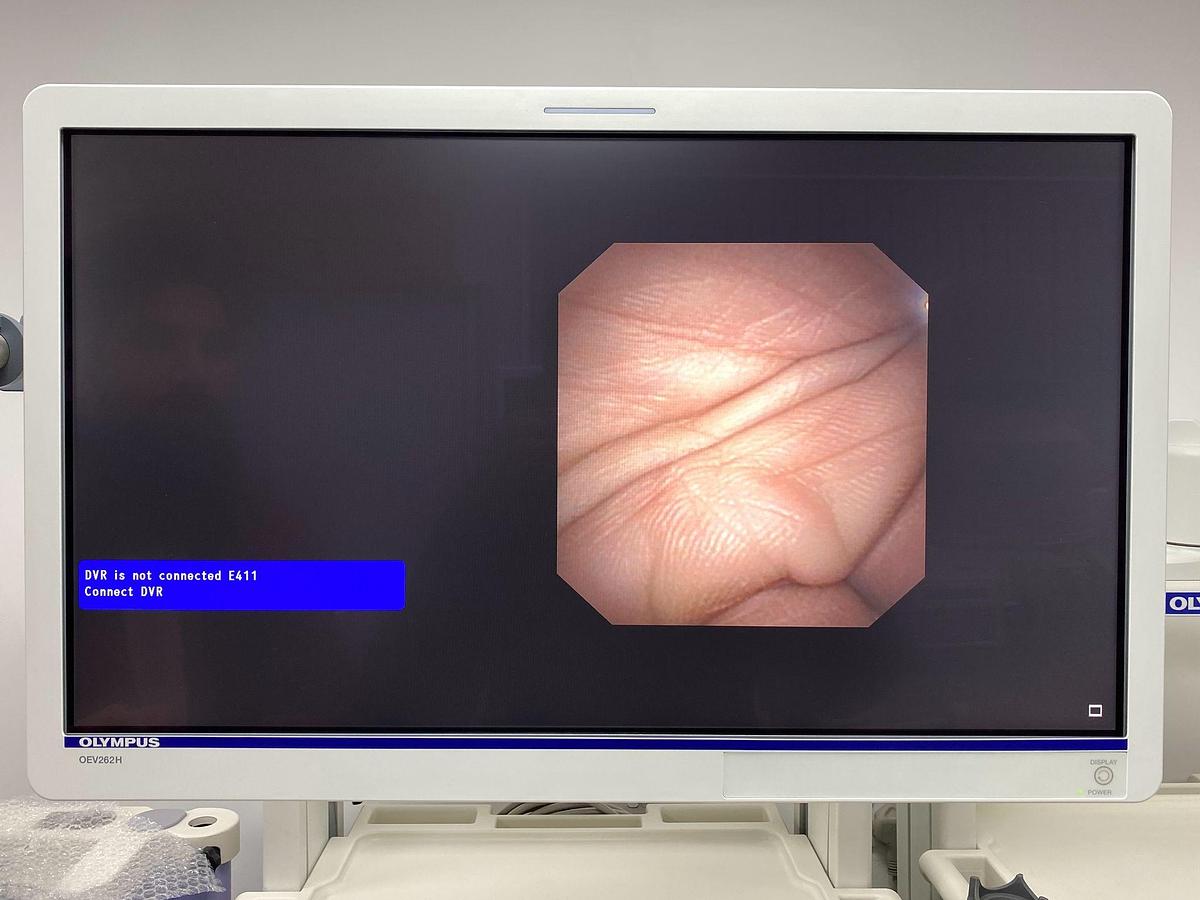 Used Olympus scope Mode: GIF-N180