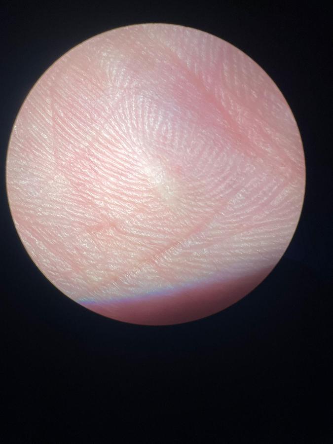 Used ZEISS S8 OPMI VISU 150 Microscope  