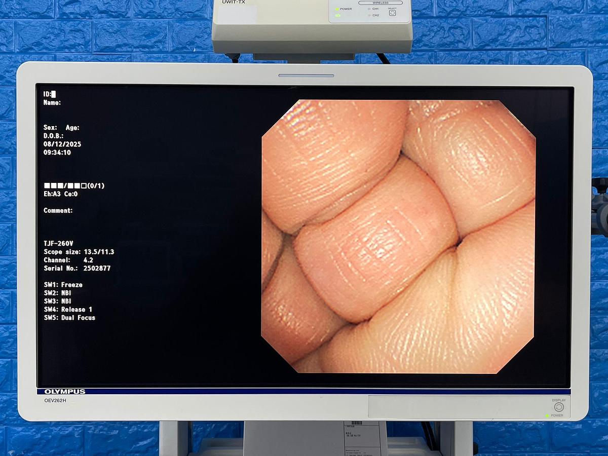 Used Olympus TJF-260V Duedenoscope
